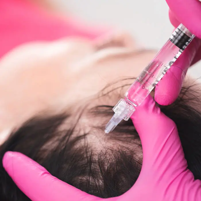 PRP Hair Treatment Melbourne
