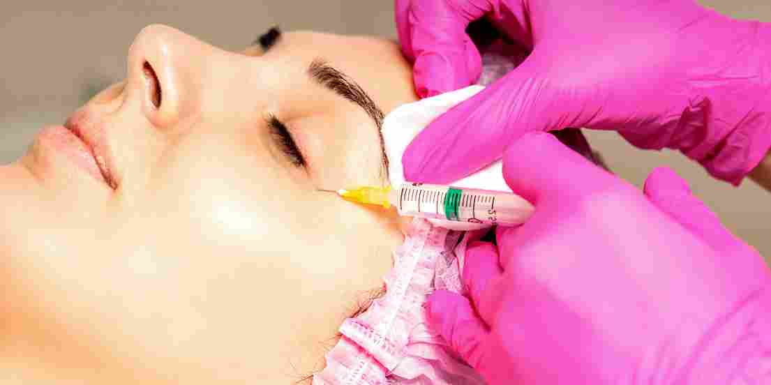 vampire facial