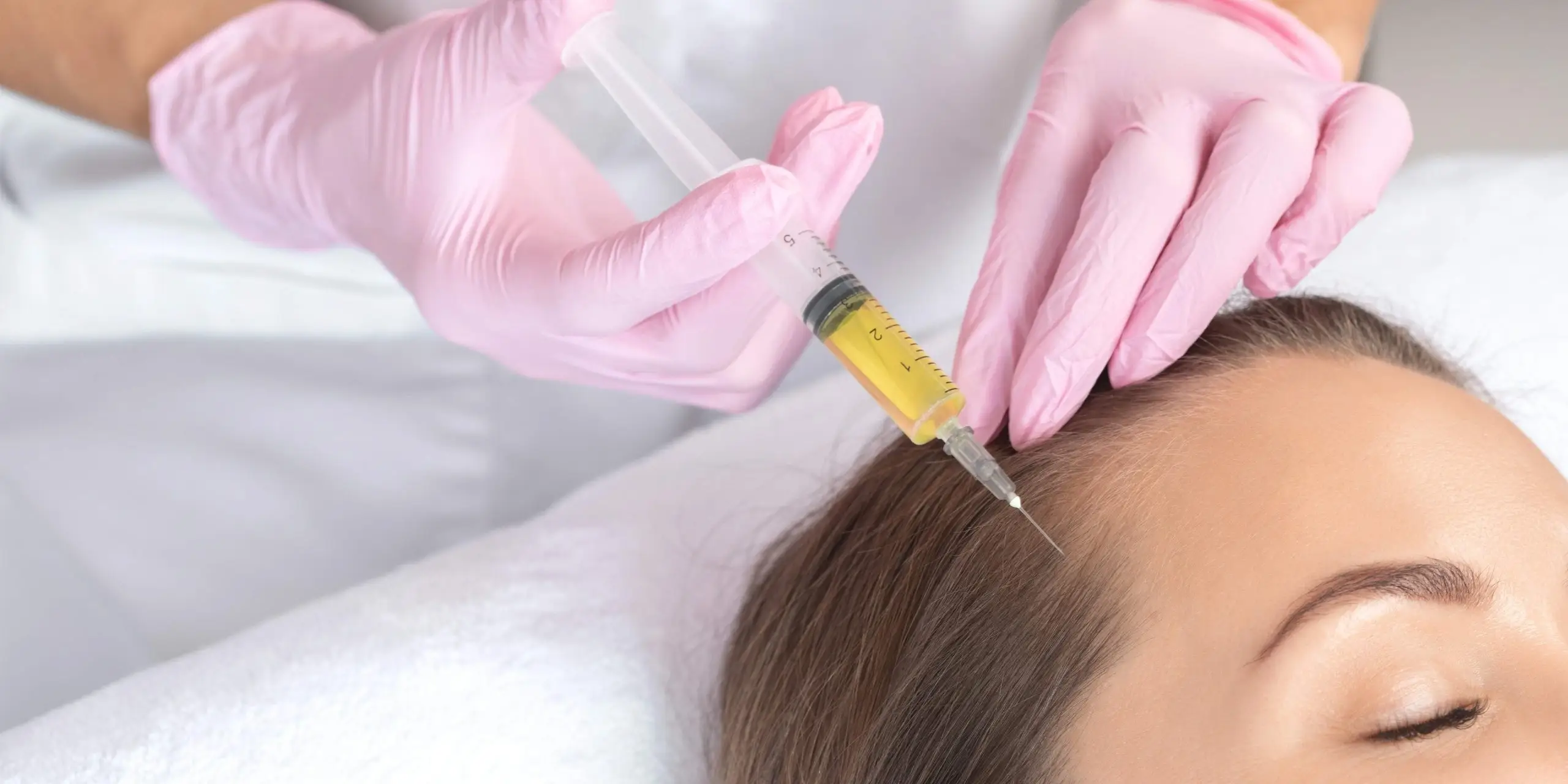 prp treatment
