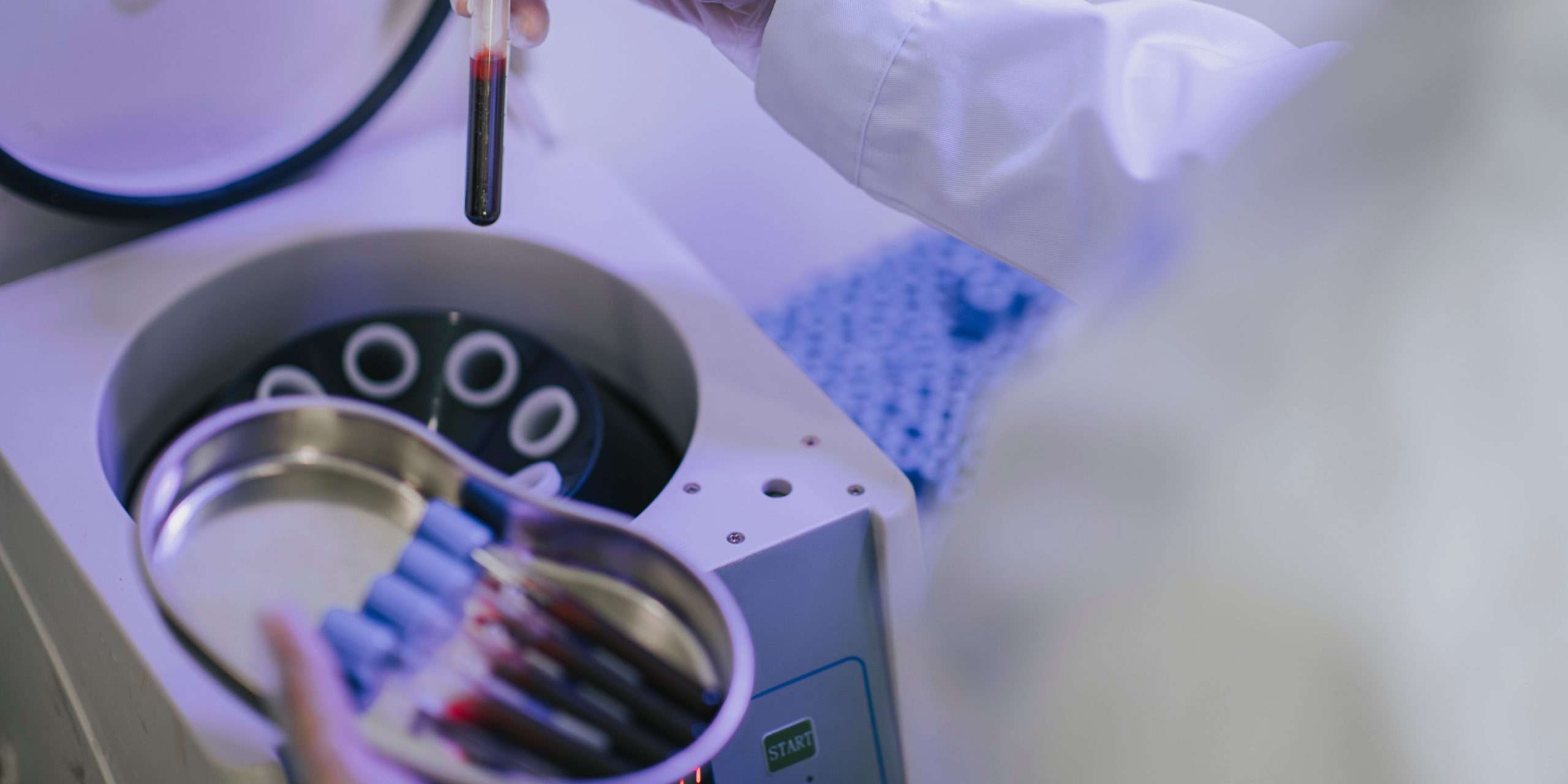 prp hair loss
