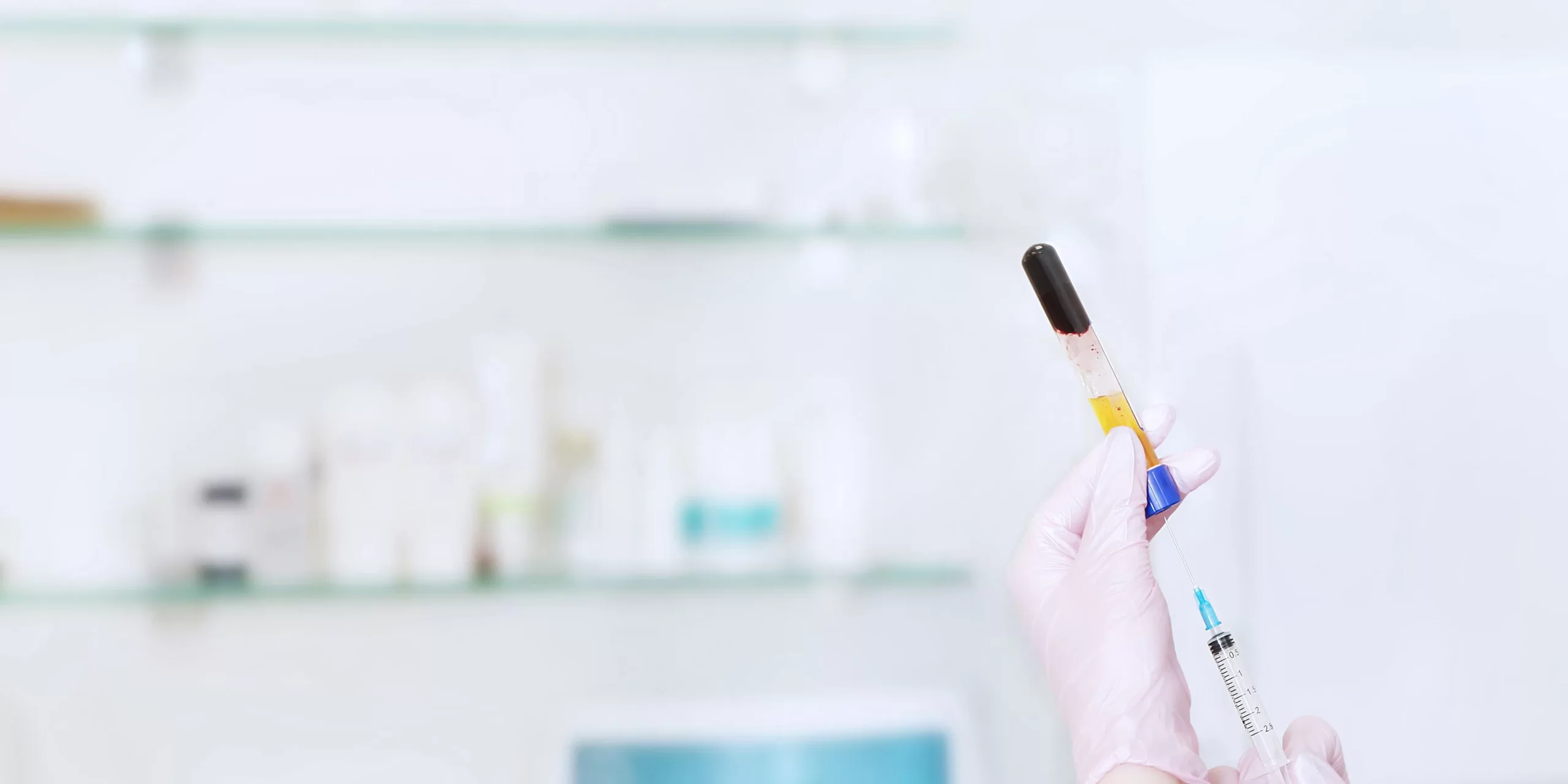 Instructions for PRP Hair Treatment for the Best Outcomes