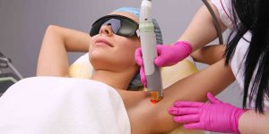 laser hair removal