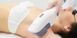 Guide for Summer-Ready Skin with Laser Hair Removal