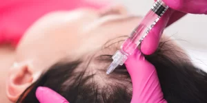 When Can I Expect to See Improvements After Getting Hair PRP Injections?